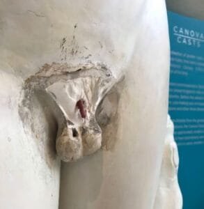 castrated statue